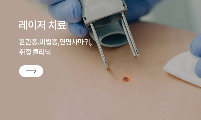 레이저치료